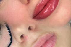 Cherry lips??

#pmulips??#permanentmakeup#amieamicropigmentation